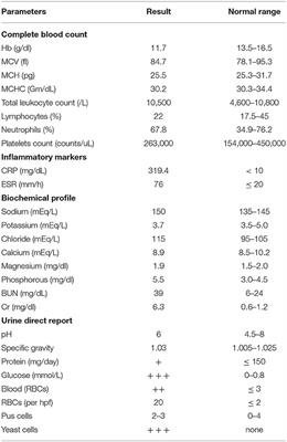 A Remarkable Case of Acute Motor-Sensory Axonal Polyneuropathy (AMSAN) Variant of Guillain Barré Syndrome, in a Diabetic Patient Infected With COVID-19: A Case Report and Review of the Literature